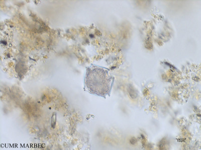 phyto/Bizerte/bizerte_lagoon/RISCO July 2016/Protoperidinium subinerme (Lagune_T1B_protoperidinium bdd-2).tif(copy)_thumb.jpg